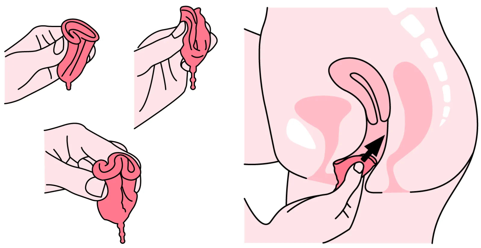 7 najczęstszych błędów przy używaniu kubeczka menstruacyjnego (i jak ich uniknąć)